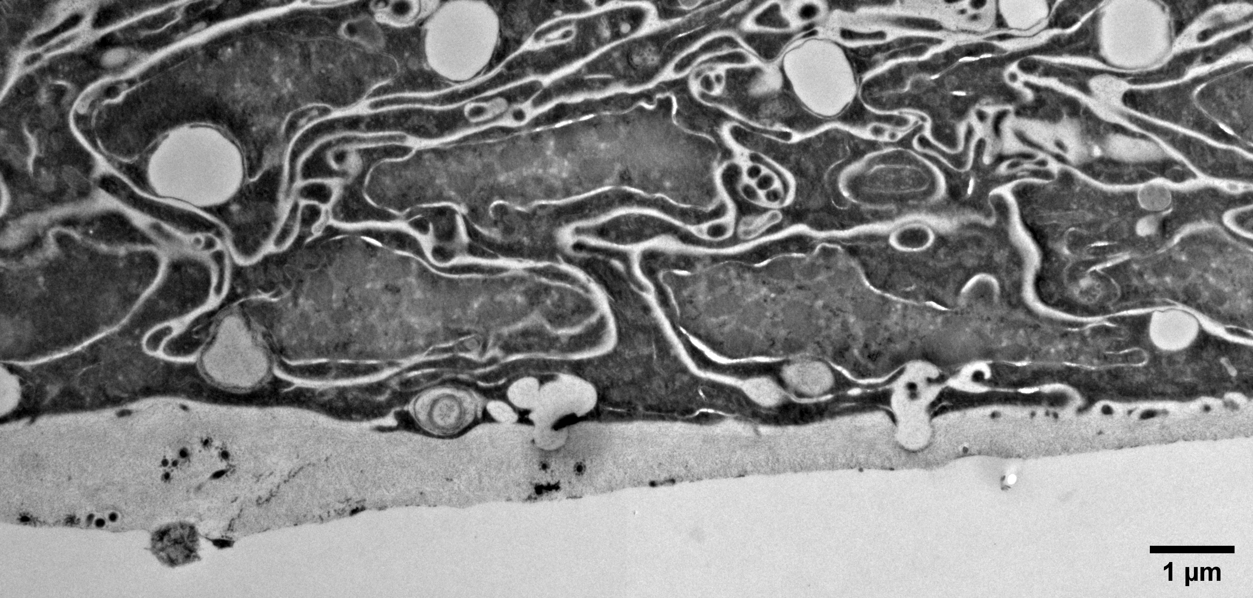 TEM-BMcolumnar2.png
